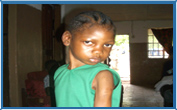 One of the children who has benefitted from our healthcare programme.